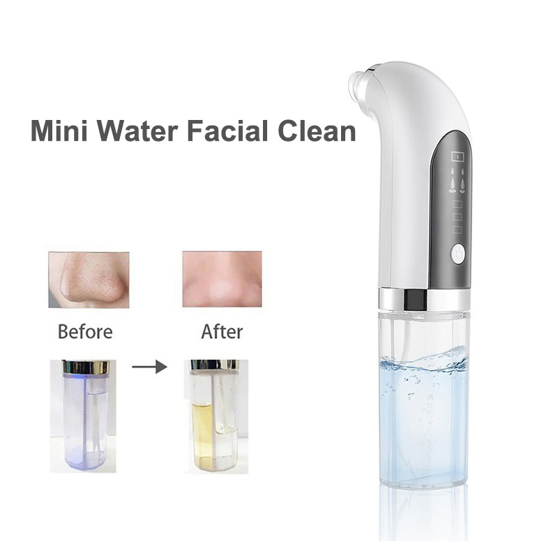 Bubble Facial & Blackhead Remove